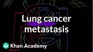 Lungs and Mediastinum – Thoracic Viscera  Lecturio [upl. by Tiffani]