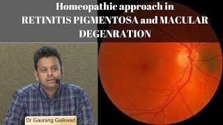 Homeopathic approach in RETINITIS PIGMENTOSA and MACULAR DEGENERATION Dr Gaurang Gaikwad [upl. by Nan691]