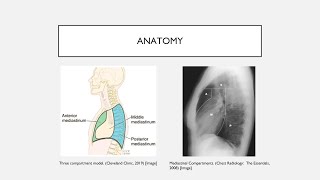 Mediastinal Masses [upl. by Marchak]