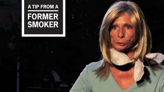 CDC Tips From Former Smokers  Terrie H’s Story [upl. by Prader]