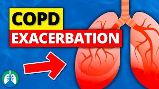 COPD Exacerbation  What is it Acute Symptoms  Definition [upl. by Dwayne]