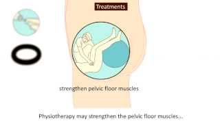 5 Symptoms to recognize Rectal Prolapse Causes Treatment  Dr Rajasekhar M R  Doctors Circle [upl. by Afaw]