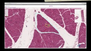 Histology Helper  Muscle Histology [upl. by Llewellyn]