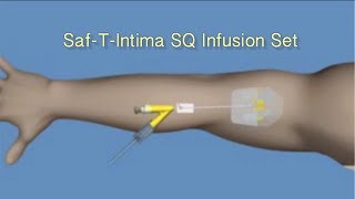 How to Insert SafTIntima™ SQ Infusion Set [upl. by Aelem618]