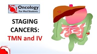 Cancer Metastasis in the Liver  All Symptoms [upl. by Corwun355]