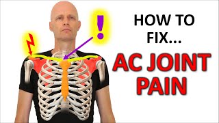 Understanding Sacroiliac Joint Pain [upl. by Eiffe379]