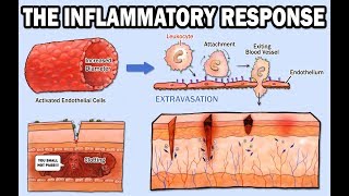 THE INFLAMMATORY RESPONSE [upl. by Acireh]