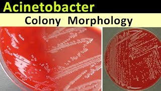 Acinetobacter Colony Morphology [upl. by Lamar922]