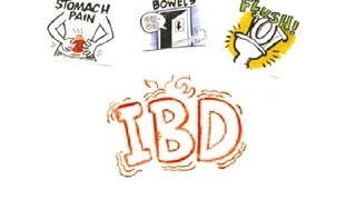 Inflammatory Bowel Disease IBD [upl. by Magnum]