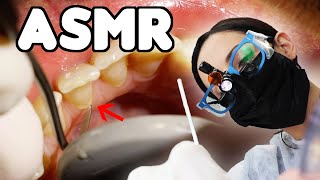 ASMR Dental Cleaning  LOTS of Scraping [upl. by Mercer124]