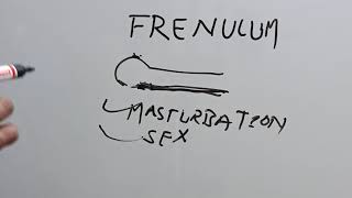 Penile Frenulum How to break Frenulum near penis shaft and head explained in hindi [upl. by Elleira]