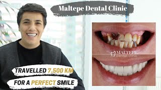 Full Mouth Restoration  Maltepe Dental Clinic Istanbul  Turkey [upl. by Ahsier]