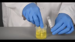 How to Use COPANs UriSponge™ for Urine Specimen Collection [upl. by Alis]