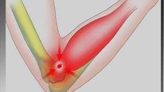 Pulmonary Rehab Daily Fitness amp Exercise [upl. by Shulman]