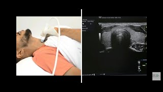 Thyroid Ultrasound Protocol [upl. by Thurlow]