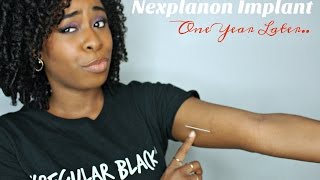 Nexplanon Implant  One Year Update [upl. by Dnalloh]