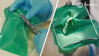 Basics of Dental Rubber Dam Placement [upl. by Monroe93]