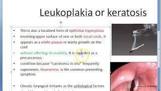 ENT 359 a Leukoplakia Keratosis Larynx PreMalignant lesion vocal cord precancerous [upl. by Garreth]