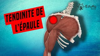 COMPRENDRE LA TENDINITE DE LÉPAULE Explications professionelles [upl. by Stepha]