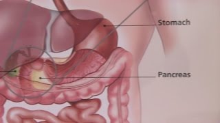 Irritable Bowel Syndrome amp Its Symptoms [upl. by Rickart]