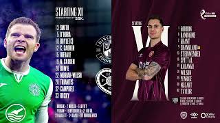 Hibernian Vs Hearts BBC Radio [upl. by Sined623]