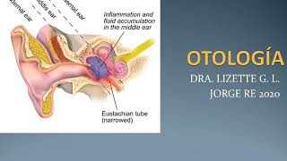 Otitis externa  Otitis media  Mastoiditis  Otoesclerosis [upl. by Eelrahs722]