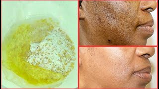 NATURAL EXFOLIATING FACIAL SCRUB FOR CLEARING BLACKHEADS DARK SPOTS DULL DRY SKIN GET CLEAR SKIN [upl. by Krystyna]