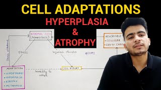 Hyperplasia amp Atrophy  Cell Adaptations 23  General Pathology  EOMS [upl. by Aurita]