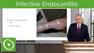 Infective Endocarditis IE Definition amp Epidemiology– Infectious Diseases  Lecturio [upl. by Singband]