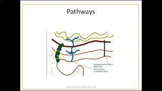 Complications of Otitis Media  1 Mastoiditis [upl. by Nolly]