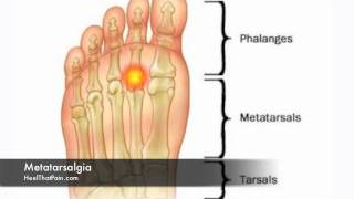 Top 3 Groin Pain Self Tests and Diagnosis SURPRISE [upl. by Ahdar]