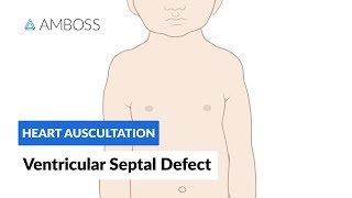 Ventricular Septal Defect VSD  Heart Auscultation  Episode 11 [upl. by Hewes]