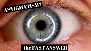 Astigmatism Explained in One Minute [upl. by Eivod]