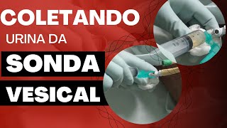 Como fazer exame de URINA em pacientes com sonda [upl. by Anibas271]