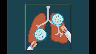 Pneumocystis jiroveci pneumonia pcp [upl. by Ikcin]