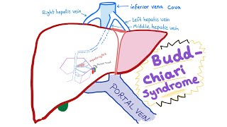 Grayson’s Syndrome The Only Known Case in Human History [upl. by Drawd]