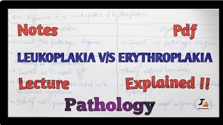 Leukoplakia Vs Erythroplakia Difference Pathology [upl. by Sachiko]