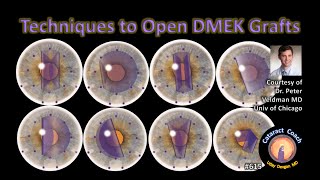 Techniques to Open DMEK grafts corneal endothelial transplantation [upl. by Llenet]