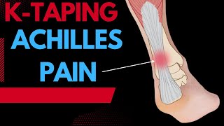 How to treat Achilles Tendonitis using Kinesiology tape [upl. by Ahseyn935]