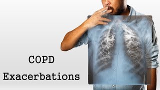 COPD Exacerbations [upl. by Niamrahc]