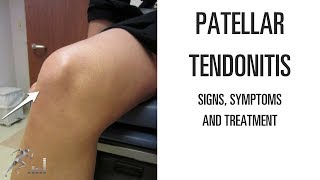 Patellar tendonitis Signs symptoms and remedies for this difficult knee problem [upl. by Esilram968]