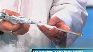 Novasure Procedure Performed on The Doctors [upl. by Alig]