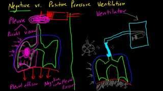 Negative vs Positive Pressure Ventilation [upl. by Ettolrahs219]