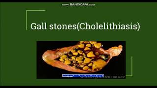 Cholelithiasis  Gallstones Pathogenesis amp Morphology [upl. by Sewole]