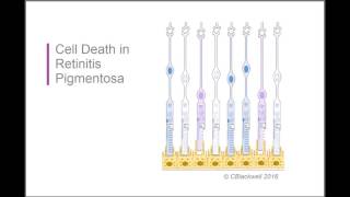 Retinitis Pigmentosa 2 Biology [upl. by Eelibuj]