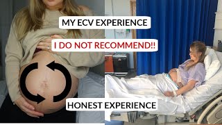 FAILED ECV 😱😨 EXTERNAL CEPHALIC VERSION MY EXPERIENCE TURNING THE BABY OUT OF BREECH POSITION [upl. by Agatha448]