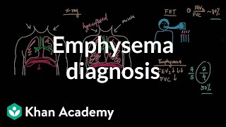 Emphysema diagnosis  Respiratory system diseases  NCLEXRN  Khan Academy [upl. by Ecaj]