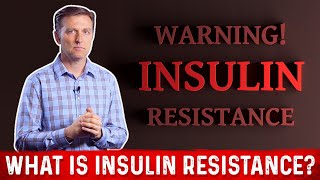 What Is Insulin Resistance – Dr Berg [upl. by Zilla378]