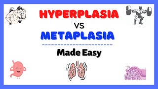 Hyperplasia and Metaplasia Dysplasia vs Neoplasia Cellular Adaptation Pathology Made Easy [upl. by Dame]