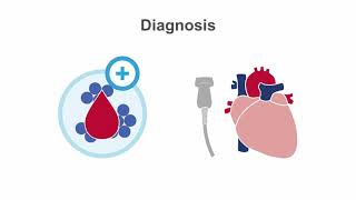 Endocarditis 101 Diagnosis and Treatment [upl. by Sevart960]